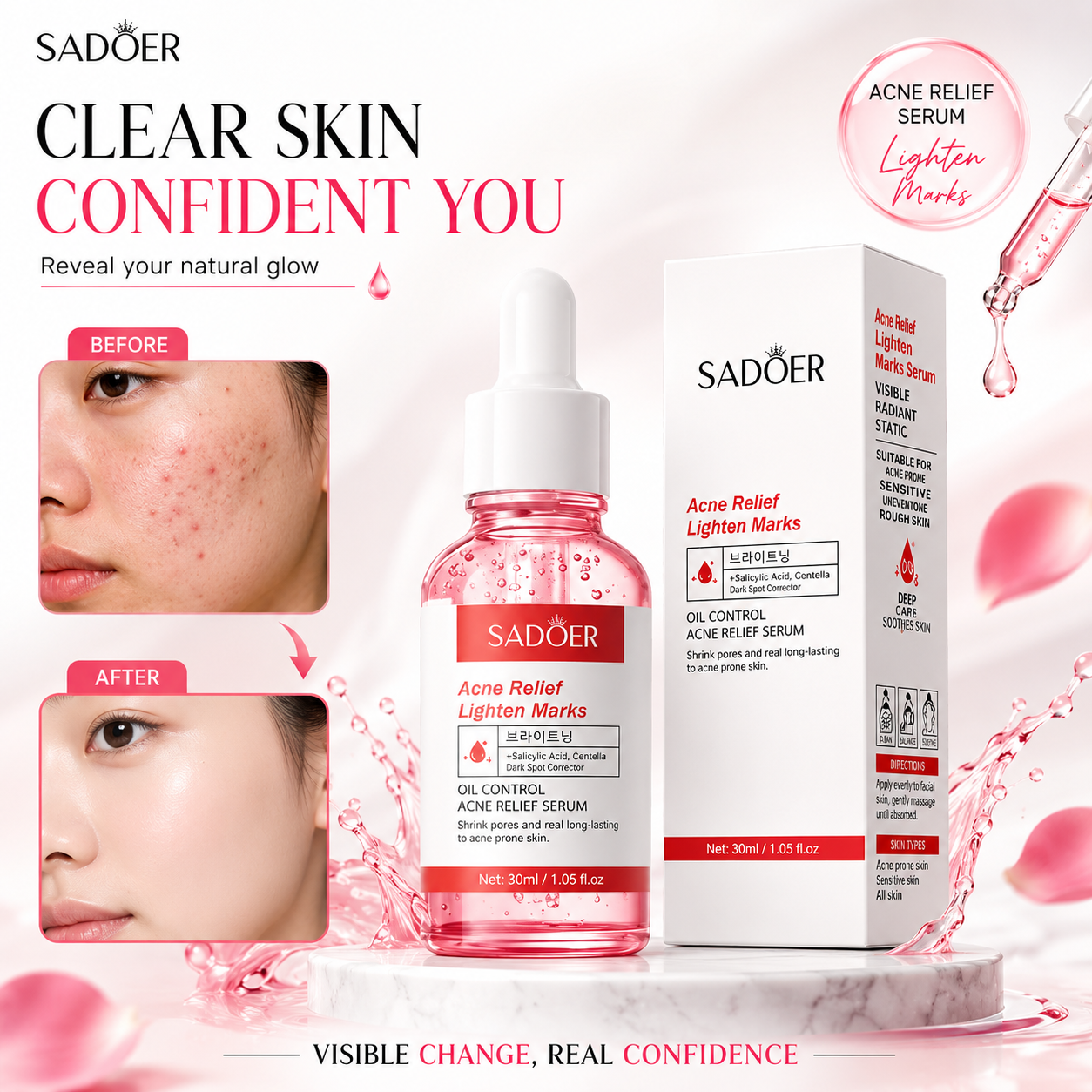 Sadoer Oil Control Acne Relief Serum Antiage Acné Hidratante 30ml